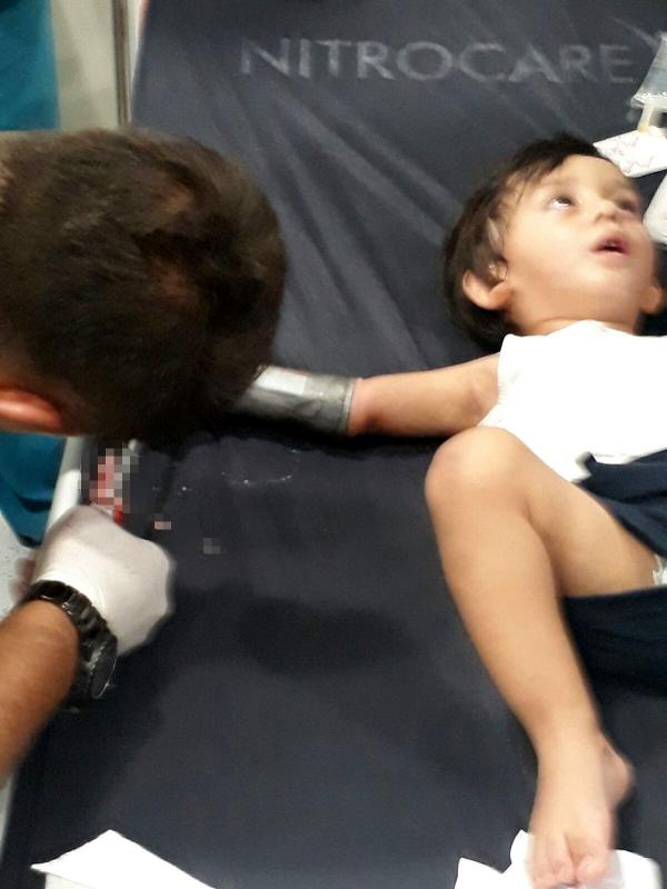 2 yaşındaki çocuk elini kıyma makinesine kaptırdı