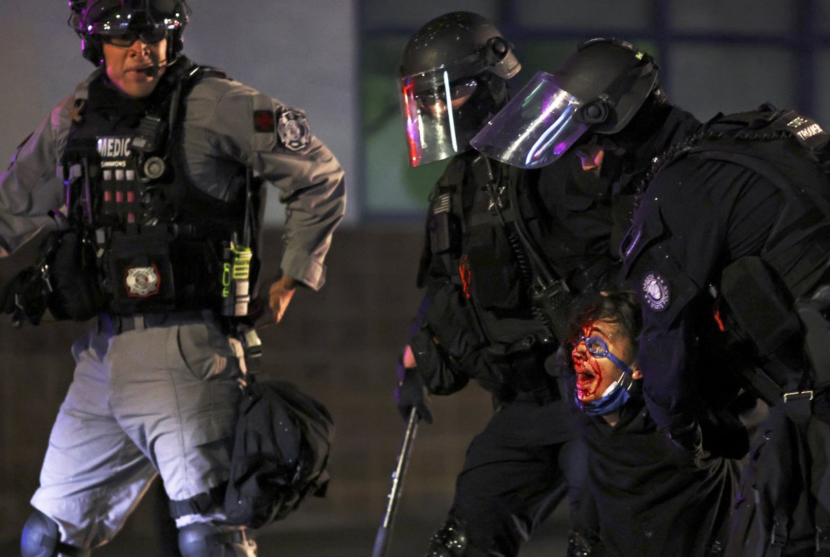 ABD polisi silahsız göstericileri döverek gözaltına aldı #1