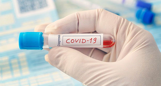 Dünya genelinde koronavirüs vaka sayısı 21 milyonu geçti #4